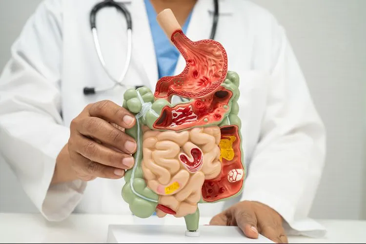 Doctor holding detailed anatomical model of the digestive system — gut barrier integrity is central to overall health